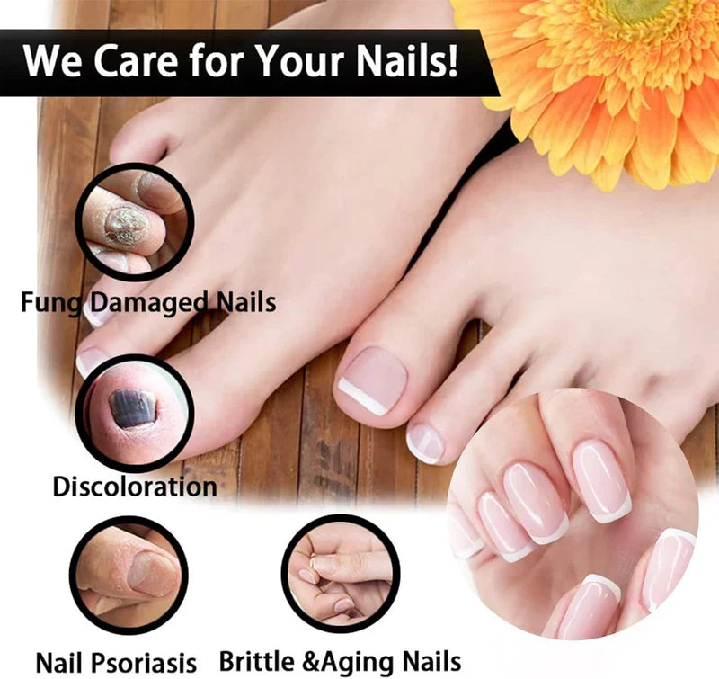 Fungal Nail Treatment Oil